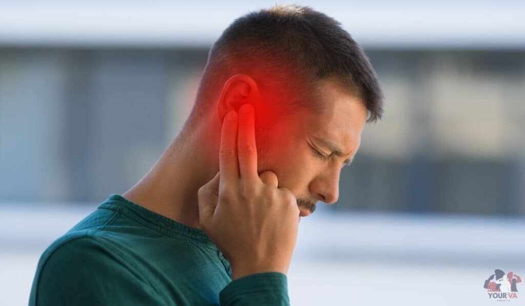 Get Your 2026 Nexus Letter for Migraines Secondary to Tinnitus: A Veteran’s Guide to Winning Your Claim
